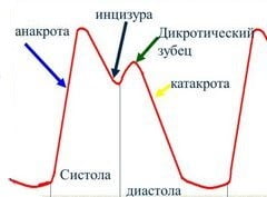 Сфигмограмма