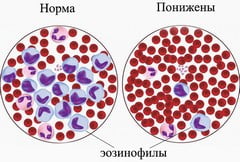 Анализ крови на эозинофилы