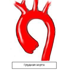 Грудная аорта